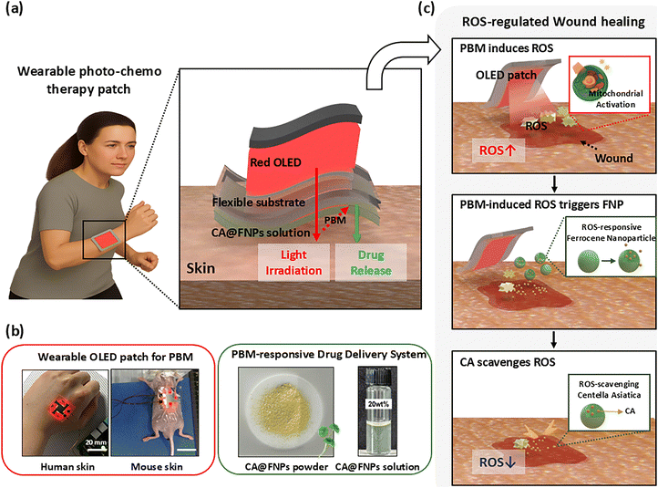 Schematic diagram of light drug combined treatment using an OLED patch